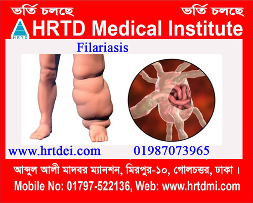 Filariasis