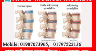 Orthopedic Diseases