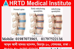 Orthopedic Diseases