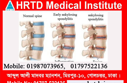 Orthopedic Diseases