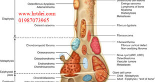 Orthopedic Pathology & Diagnosis