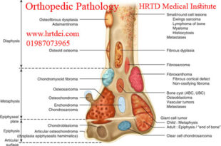 Orthopedic Pathology & Diagnosis