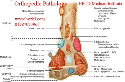 Orthopedic Pathology & Diagnosis