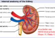 Chronic Kidney Disease (CKD)