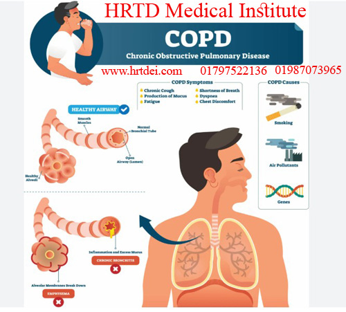 COPD/Chronic Obstructive Pulmonary Disease