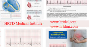 Bradycardia Management