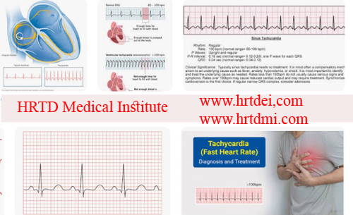 Tachycardia Management System