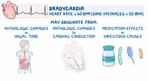 Bradycardia Management  7 image